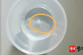 医生从患者眼睛中取出数条细长的线虫图片