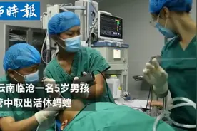 细思极恐！活体蚂蟥在5岁男孩体内存留1年多，疑因喝生水所致图片