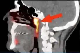 科学家意外发现人体新器官图片