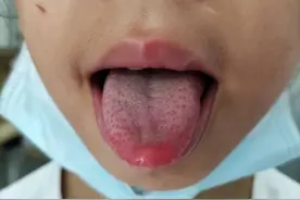 9岁女孩一个月至少病一次，医生一查：竟然是爸爸的“锅”图片