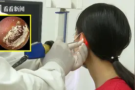 不要盲目掏！小伙享受“采耳”服务后 耳道长满“白毛”图片