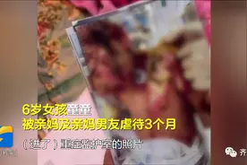 6岁女童被亲妈及其男友虐待险丧命！孩子姥姥报警：判他们死刑图片