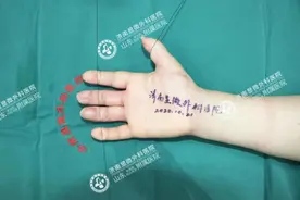 操作不慎致三指缺损，医生12小时再造，患者直呼太神了……图片