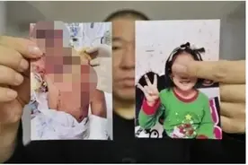 6岁女童遭亲妈沸水浇头、铁钳拔牙、烧嘴唇…… 最新官方通报：被告人将被从重从快严惩图片