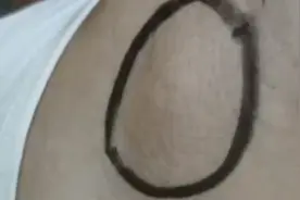 9岁女童得怪病竟是撸猫惹的祸！医生：严重可能导致失明