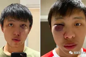 国外针对亚裔的恶意袭击显著增多，罗杰叔叔都没能幸免图片