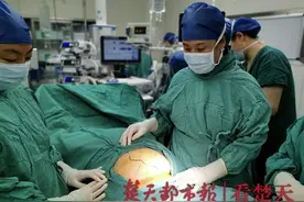 世界罕见！胎儿在母体子宫外腹腔长了26周！胎盘血管盘根错节……图片
