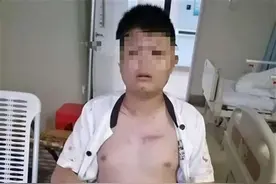湖南一小伙在超市买到过期食品，要求更换商品却被打断12根骨头图片