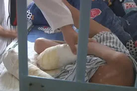 揪心！男童疑遭生父烟头烫伤或截肢，网友怒了→图片
