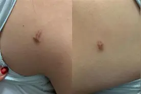 女歌手整形失败索赔百万，医院称其维权行为侵害名誉权，反诉索赔150万图片