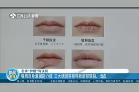 这三大诱因易导致唇部皲裂、出血，冬季“护唇”有诀窍，快掌握！