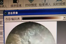 熊孩子耳朵里塞玩具，取出一物还有一物图片