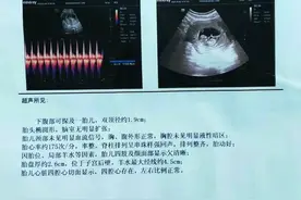 精神病女患者住院期间怀孕，医院：护工干的，医院没多大责任图片