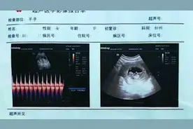 女精神病患者住院怀护工孩子，医院：不关我们事视频封面