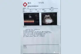 河北女精神病人与护工“自愿”发生关系怀孕 警方：已对护工采取监视居住图片