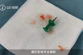 ​家长注意了！上海9岁男孩吸入图钉，手术一小时才取出：随时可能刺破气管，或引发窒息视频封面