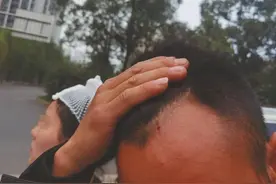 天降无人机 砸伤看表演的夫妻俩图片