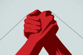 腱鞘囊肿多发于腕背和足背部 避免过度劳累是预防关键图片