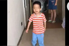 4岁男孩连续多年肢体疼痛，原来是患了全球仅十几例的罕见病图片