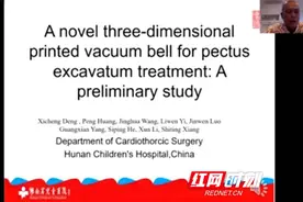 3D打印漏斗胸吸盘 为漏斗胸患者提供新型治疗方式图片