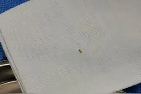 别小瞧刺伤！一根3毫米小刺扎手女子ICU住半月，罪魁祸首是它图片