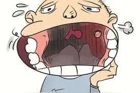 槟榔有毒，小心口腔癌图片