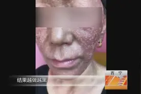 女子去美容院祛斑，结果变“花脸”图片