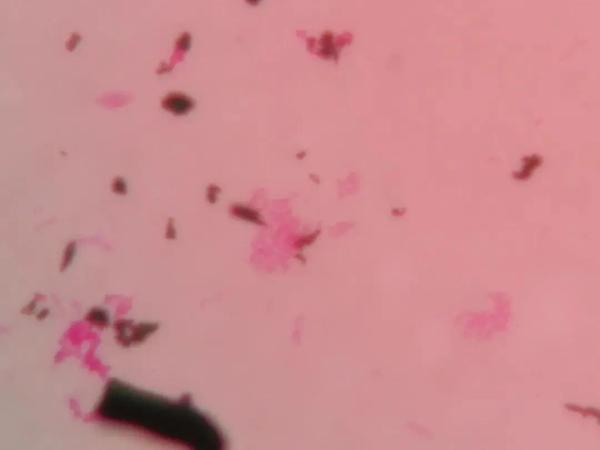 连烧5天！男子喝鲜奶后患“怪病”，真相令人惊讶