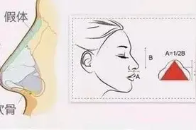 为什么隆了鼻还是不好看？你与美鼻之间还差“临门一脚”图片