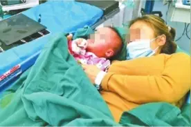 女儿患罕见骨病 90后妈妈截骨救女图片