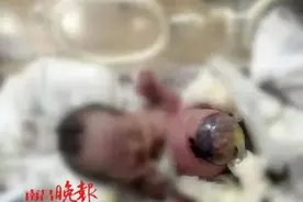 揪心！南昌一新生儿，内脏暴露在外……图片