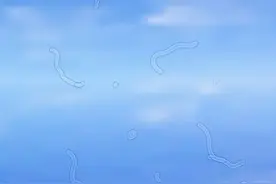 眼前总有黑影飘来飘去？真相在这……图片