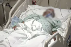 北美观察丨医疗资源缺乏病患人数超多 美国社区医院难求生图片