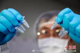 国际最新研究：新冠病毒或能通过鼻子进入大脑图片