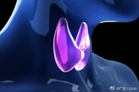 哪些因素可导致甲状腺功能减退症图片