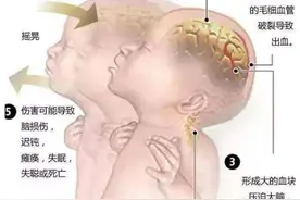 “摇晃”式哄娃儿暗藏的危险——您知道吗？图片