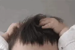痒到想死！孩子得了荨麻疹，怎么办？图片
