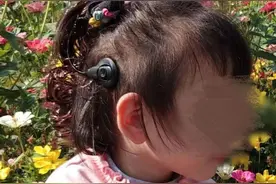 转发扩散！3岁女童人工耳蜗外挂机丢失，上面有彩色小花配饰图片