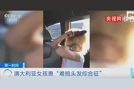 爱因斯坦同款！澳大利亚女孩患“难梳头发综合征”，曾被嘲笑像“手插在了电源里”图片