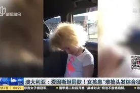 澳大利亚：爱因斯坦同款！女孩患“难梳头发综合征”视频封面