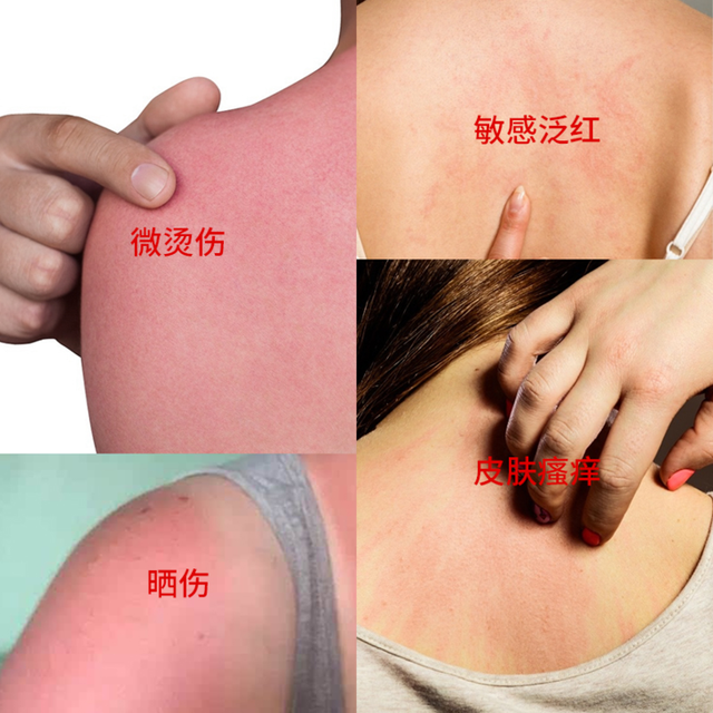 新生儿抹身体乳好还是精油好