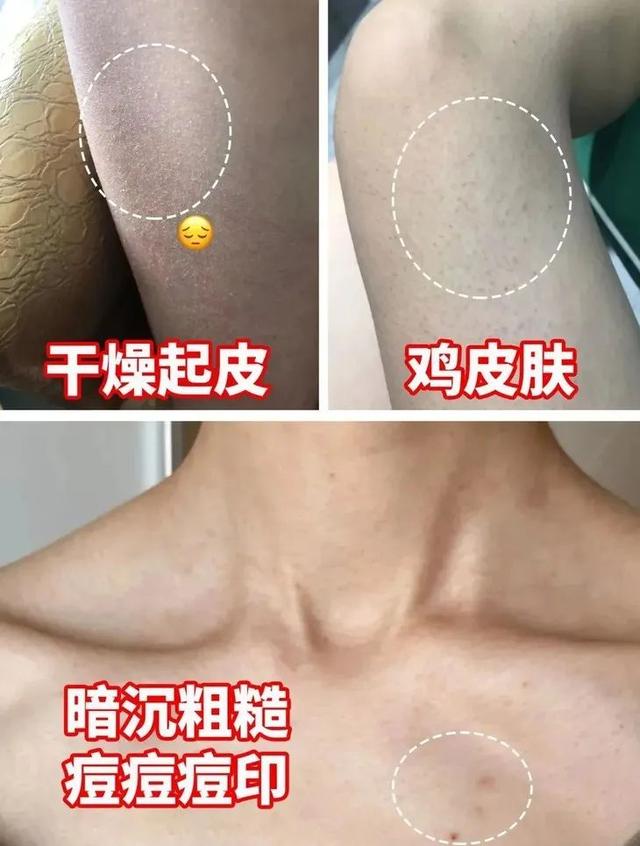 新生儿抹身体乳好还是精油好