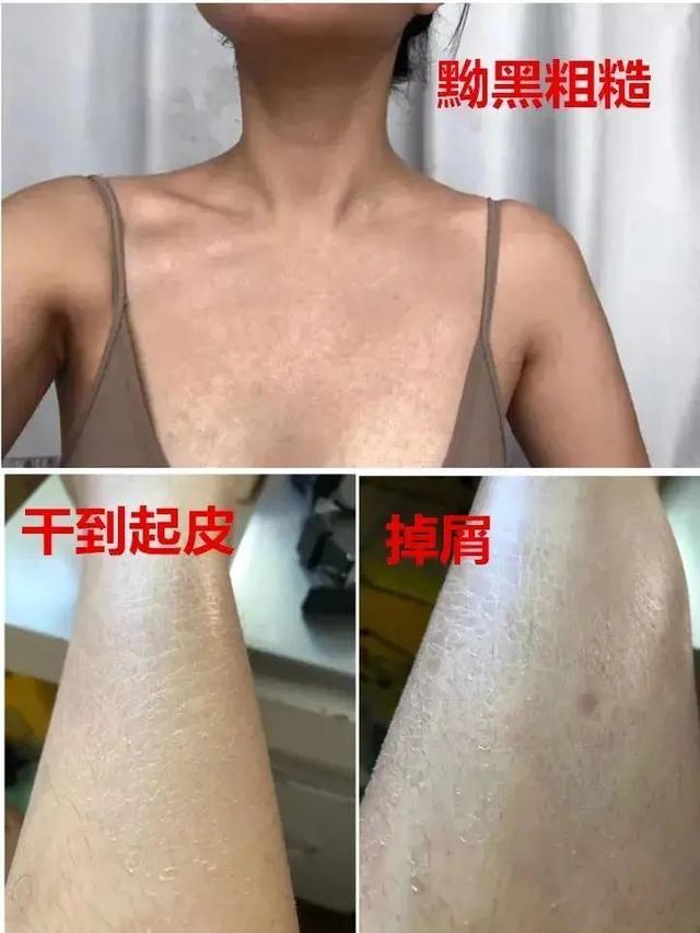 新生儿抹身体乳好还是精油好