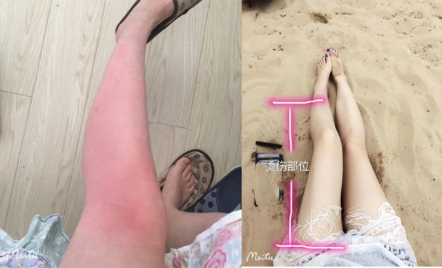 新生儿抹身体乳好还是精油好