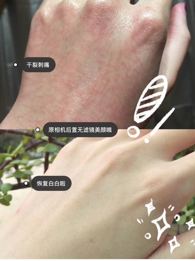 新生儿抹身体乳好还是精油好