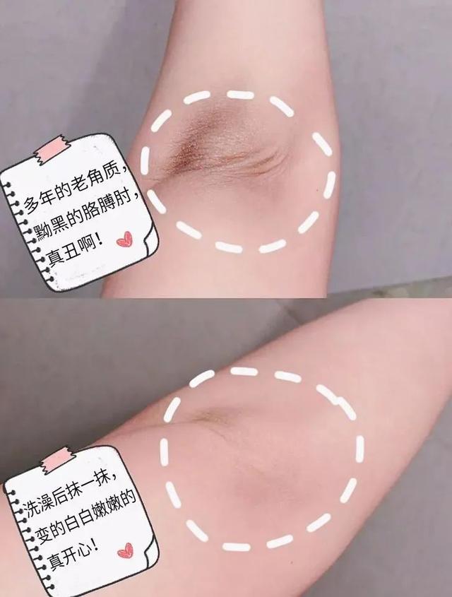 新生儿抹身体乳好还是精油好