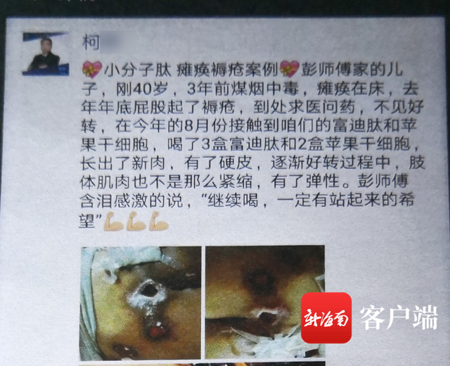 富迪小分子牡蛎肽功效价格 2024年最新富迪小分子牡蛎肽功效价格