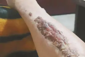 新燃气灶用10分钟就起火，烧了半个厨房图片