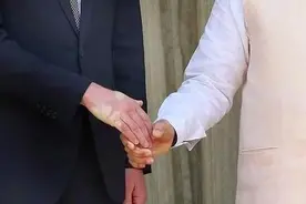 握握手，就知道有没有病？图片