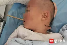 家长得当心！奶奶把苹果用筷子插着给2岁孙子吃，孩子不慎摔倒脖子被筷子戳穿图片